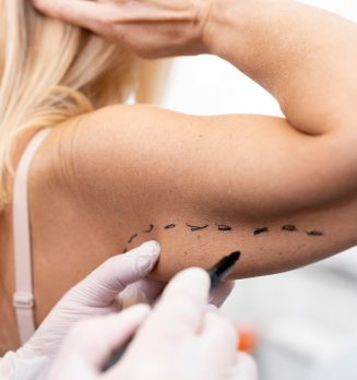 Braquioplastia: Indicações, Procedimento e Recuperação